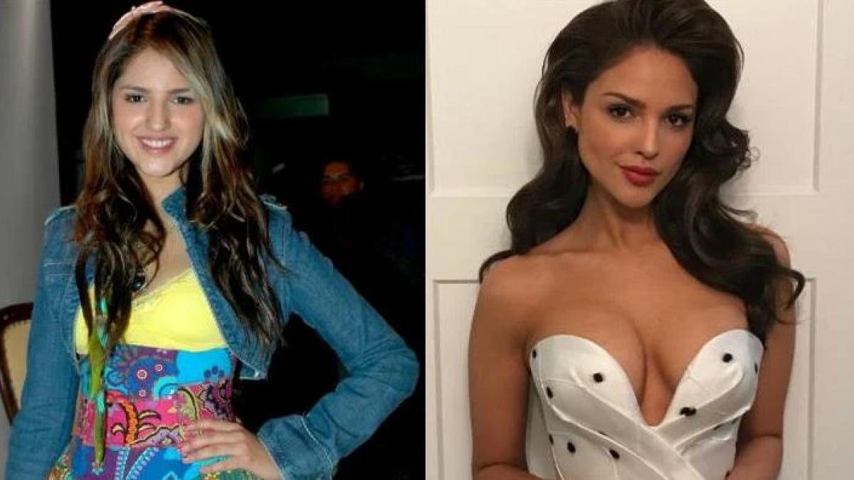 Eiza González: Así se veía la actriz antes y después de operarse (FOTOS)