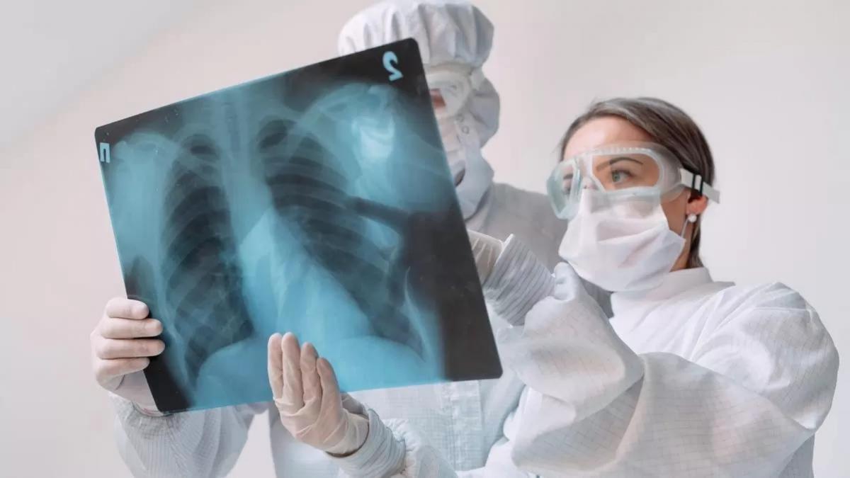 Casos de tuberculosis en México aumentan 45.3%