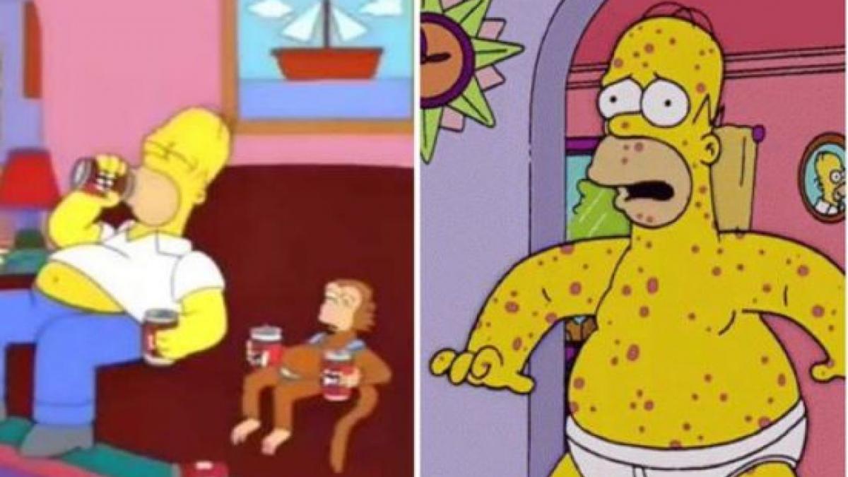 ¿Los Simpson predijeron la viruela del mono?