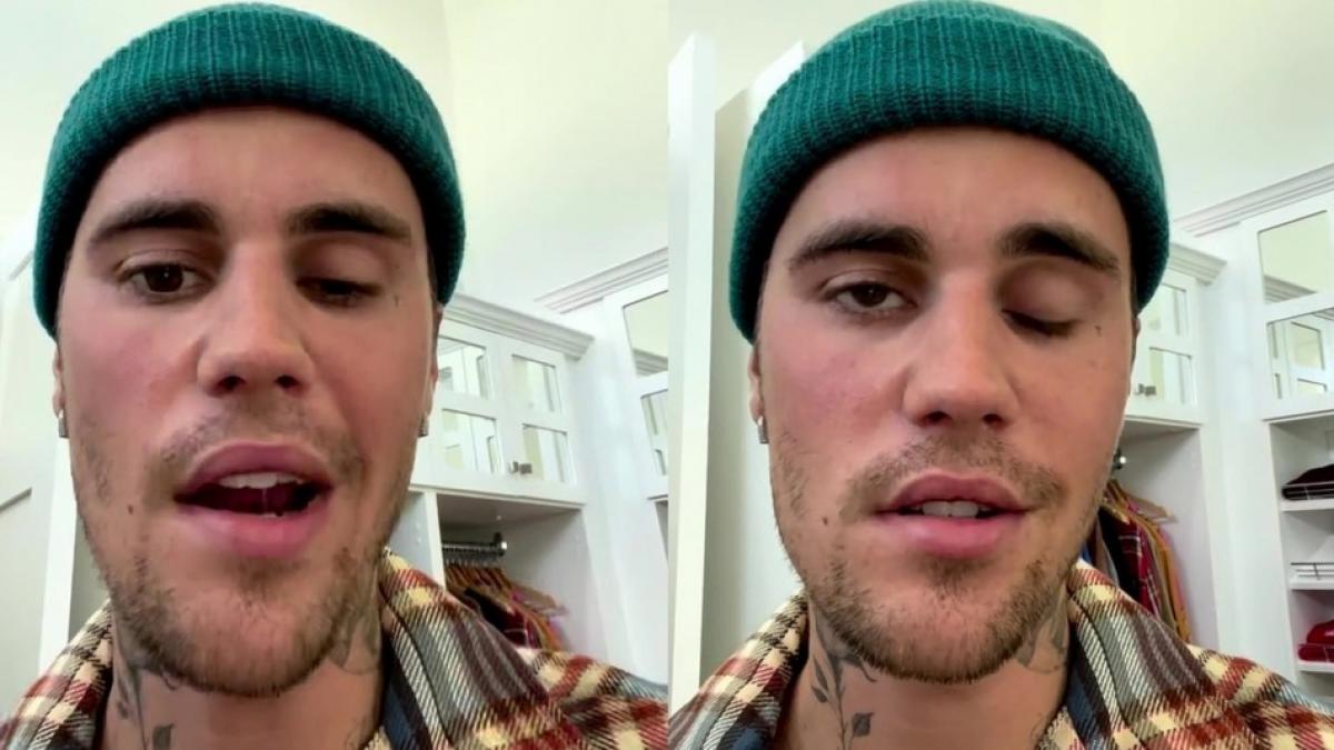 Justin Bieber muestra su parálisis facial ¿Qué es el extraño síndrome que padece?