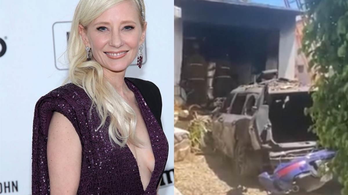 Anne Heche sufre devastador choque; se encuentra en estado crítico (VIDEOS)