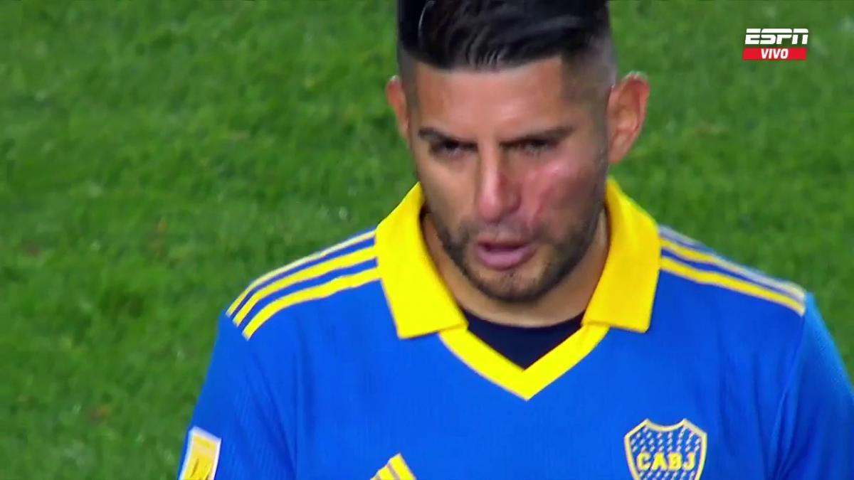 Boca Juniors: Estrellas xeneizes se agarran a puñetazos en el medio tiempo y salen al segundo con los pómulos hinchados (VIDEO)