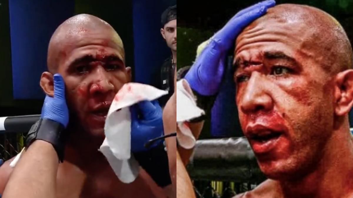 UFC | VIDEO: Peleador termina con BRUTAL herida en el rostro (imágenes sensibles)