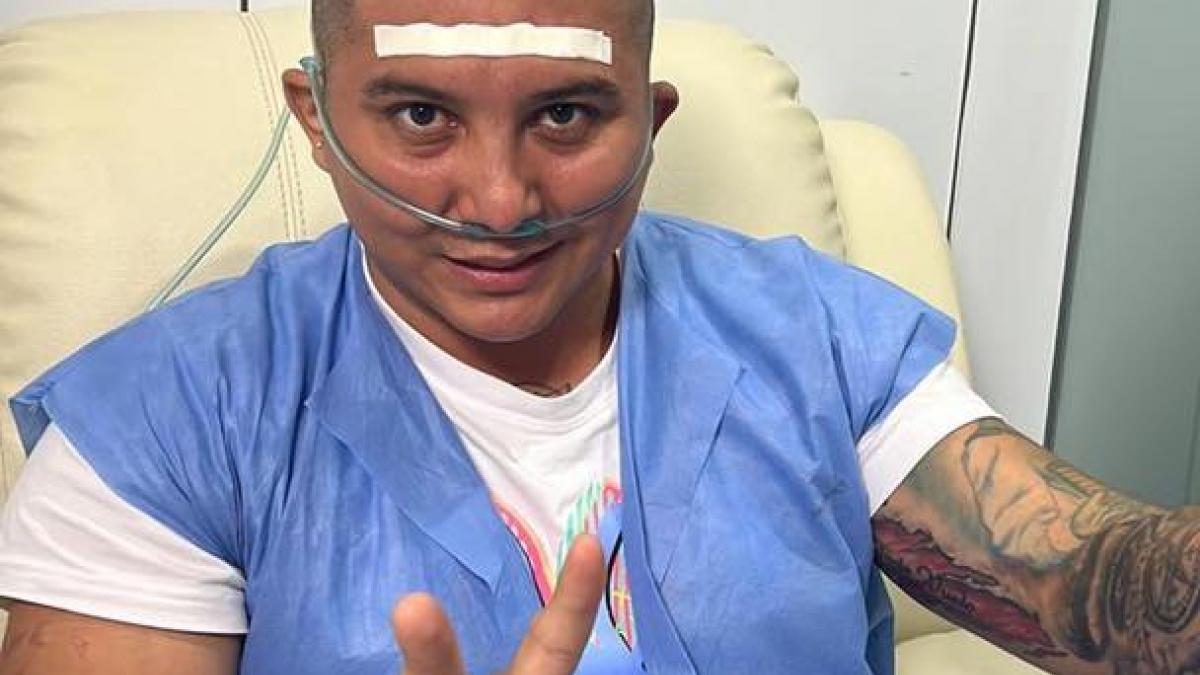 Edwin Luna se injerta cabello: "Me estaba quedando sin tierra en la maceta" (VIDEO)