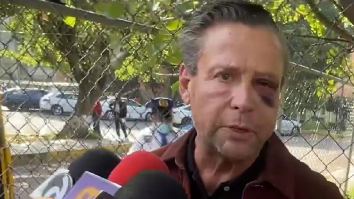 Alfredo Adame tiene miedo de que agresores lo vuelvan a atacar: "Pueden aventarme un tiro" (VIDEO)