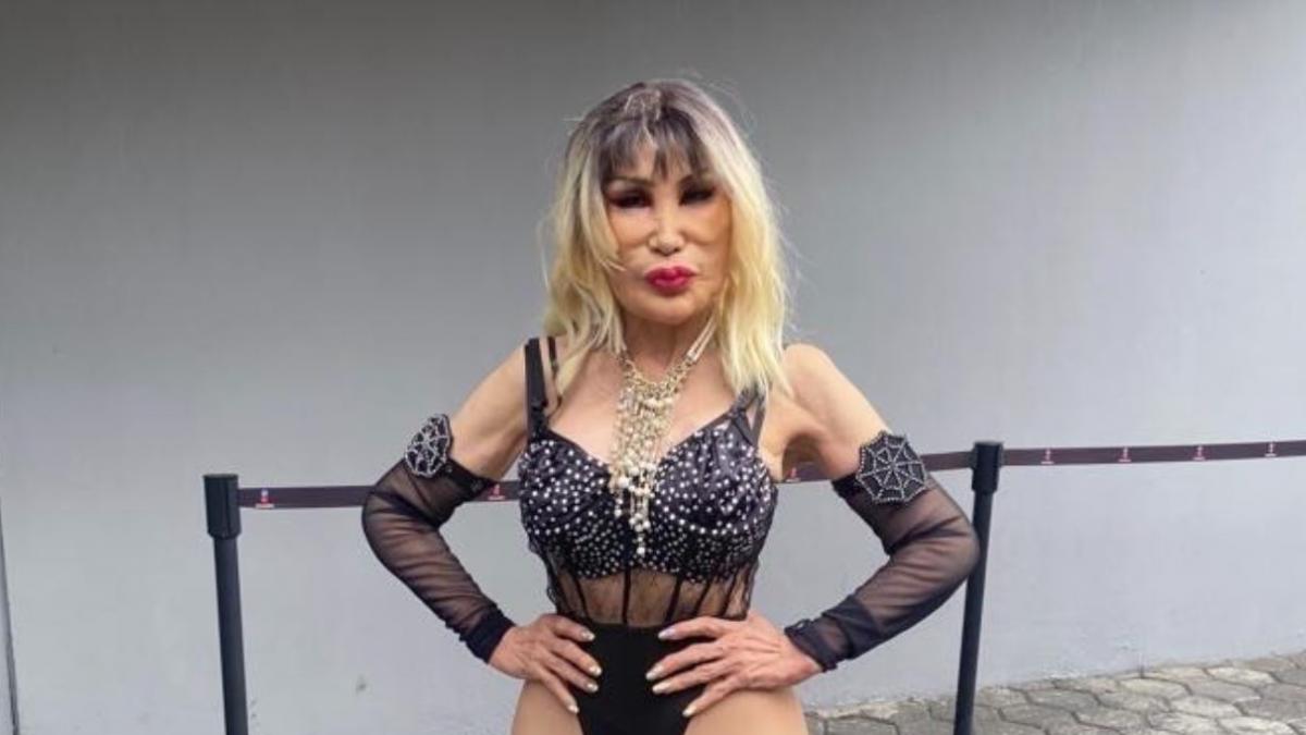 Lyn May impacta con FOTO de antes de tratamiento que le deformó la cara