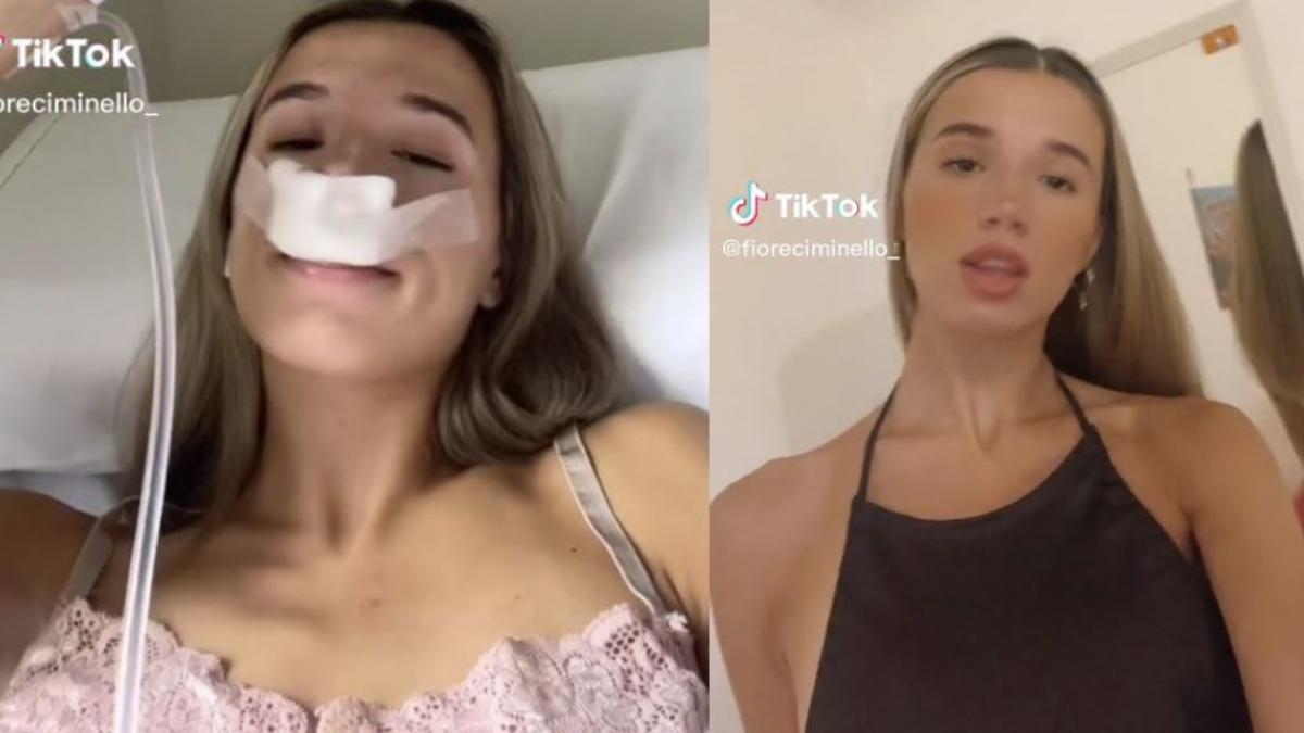 Tiktoker se opera la nariz para que sus hijos nazcan lindos y se burlan de ella (VIDEO)