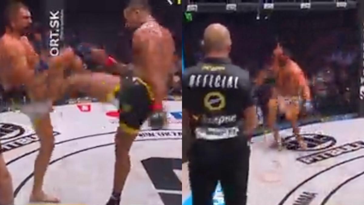 VIDEO: ¡Terrible! Peleador de MMA se rompe la pierna de la manera más escalofriante durante un combate