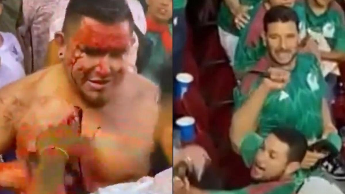 Copa Oro 2023: Aficionado apuñalado en el México vs Qatar habla desde el hospital; "sólo le quise quitar la navaja" (VIDEO)