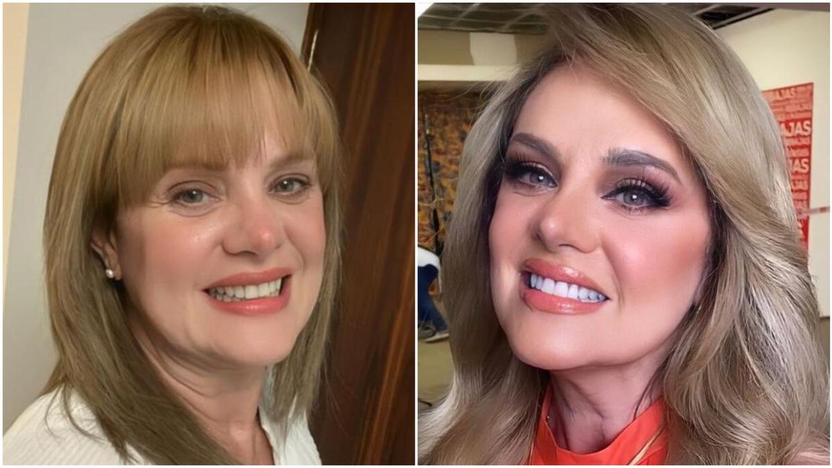 Erika Buenfil presume cómo se hace un arreglo estético en la cara: 'no duele nada' (VIDEO)