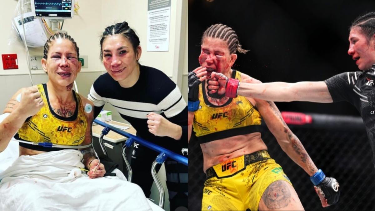 UFC: Así quedó el rostro de Irene Aldana y de su rival tras la brutal pelea que ganó la mexicana