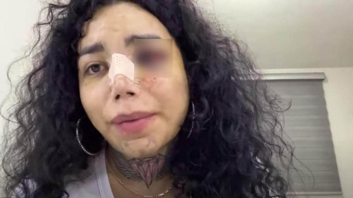 Fan se tatúa la cara golpeada de Paola de Las Perdidas: 'Inmortalizada' VIDEO