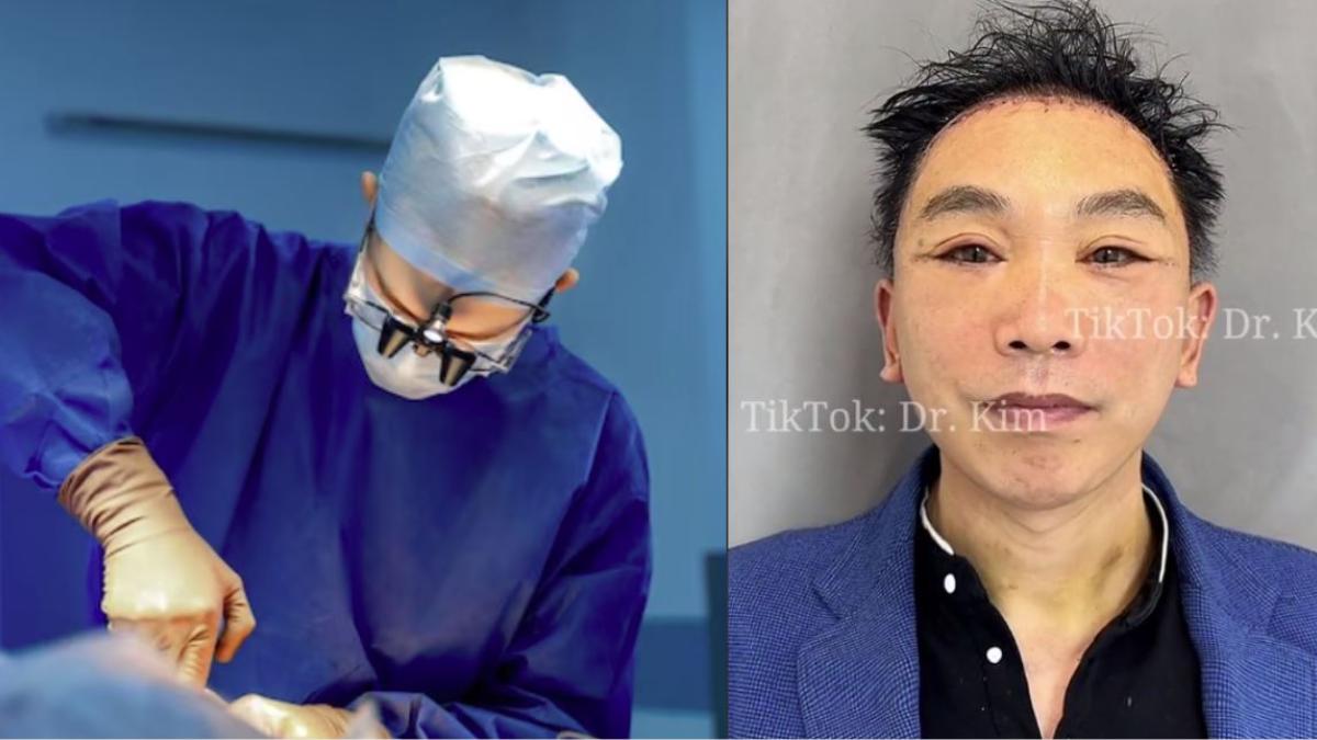 Él es el Dr. Kim, cirujano que aterra TikTok; Estos son sus VIDEOS más perturbadores