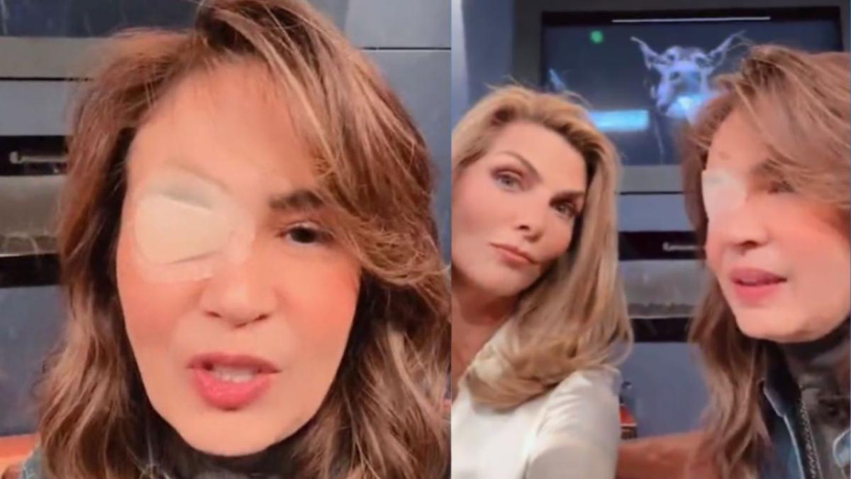 Así se ve Yolanda Andrade sin su parche en el ojo, tras su aneurisma (FOTO)