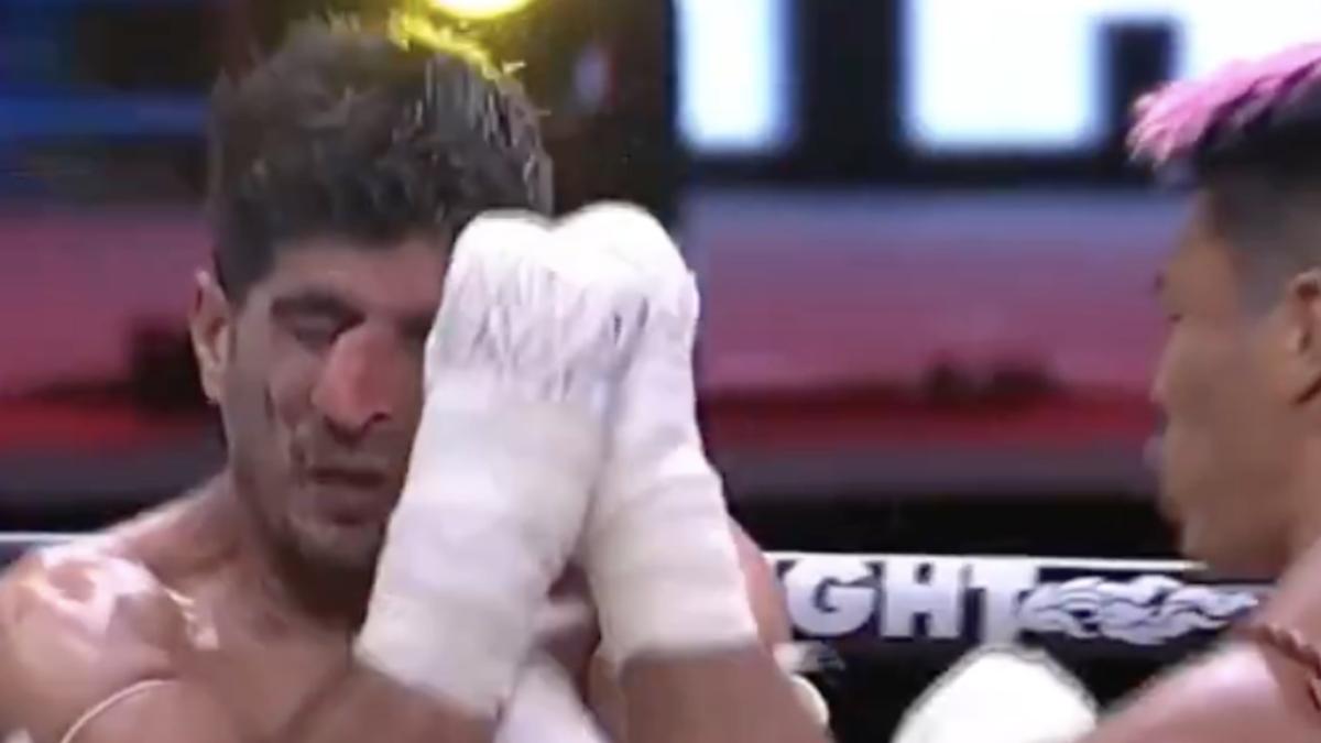 Peleador de kickboxing termina con la nariz destruida tras un brutal golpe y las imágenes son terrorífica (VID0)