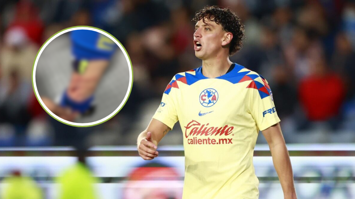 Liga MX | Igor Lichnovsky muestra su tremenda herida en el Pumas vs América (FOTO)