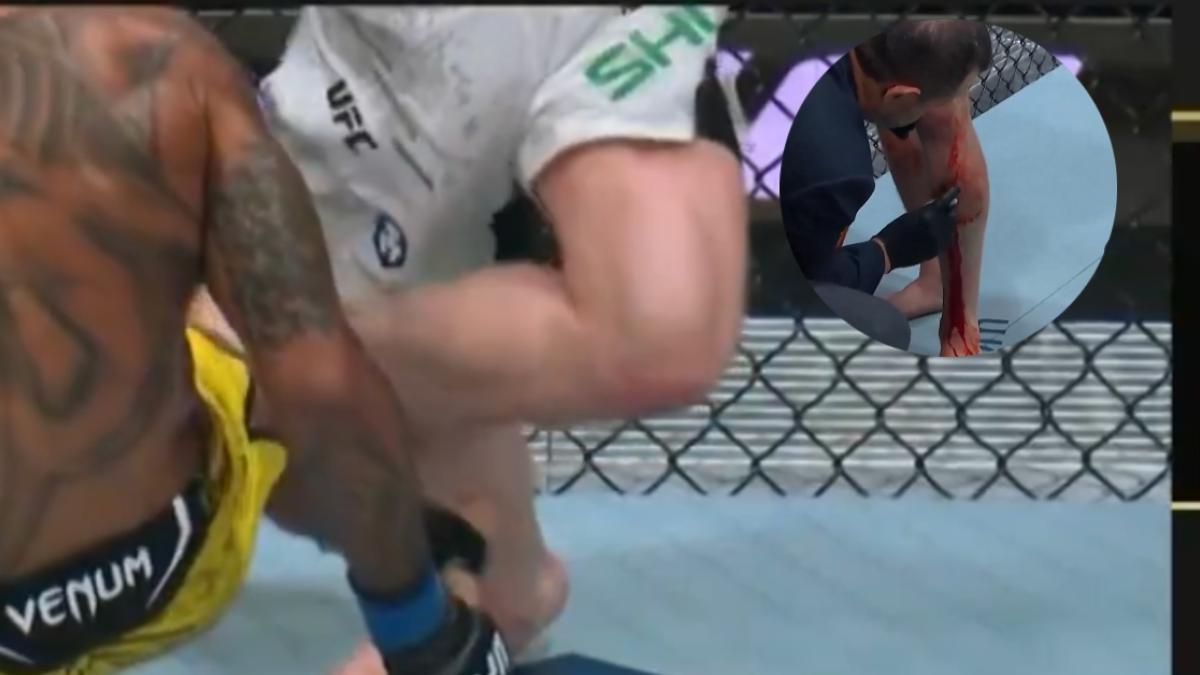 UFC 301 | ¡Imágenes sensibles!; Jack Shore sufre escalofriante corte en la pierna (VIDEO)