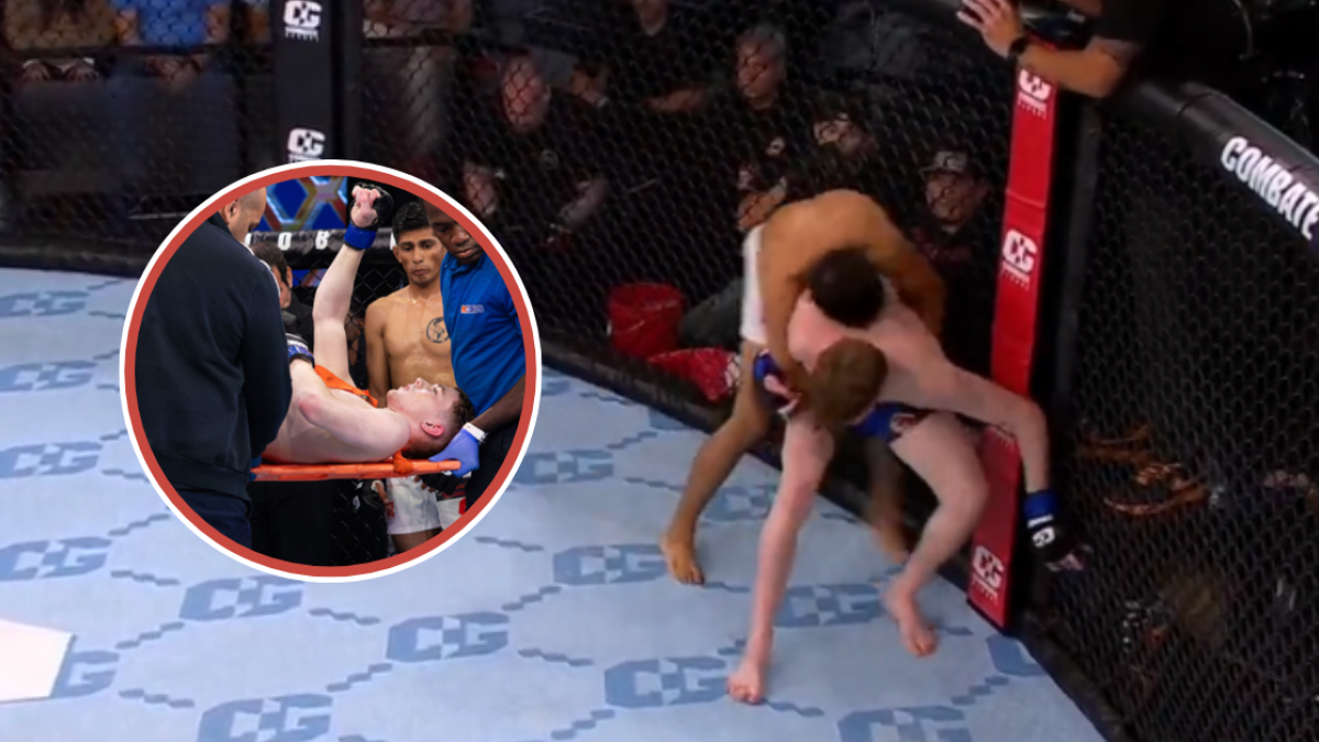 VIDEO | Una de las peores y escalofriantes lesiones de la UFC se hace viral en internet (imágenes sensibles)