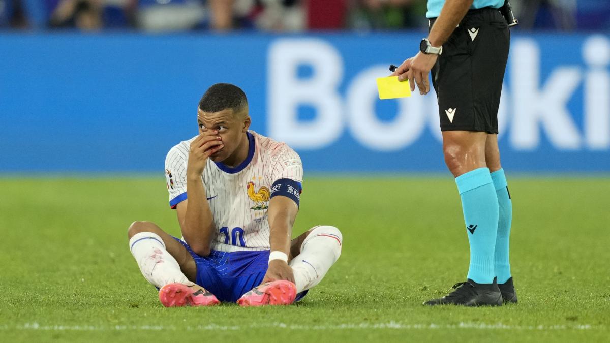 Eurocopa 2024 | Kylian Mbappé y el consejo que necesita para poder seguir jugando el torneo