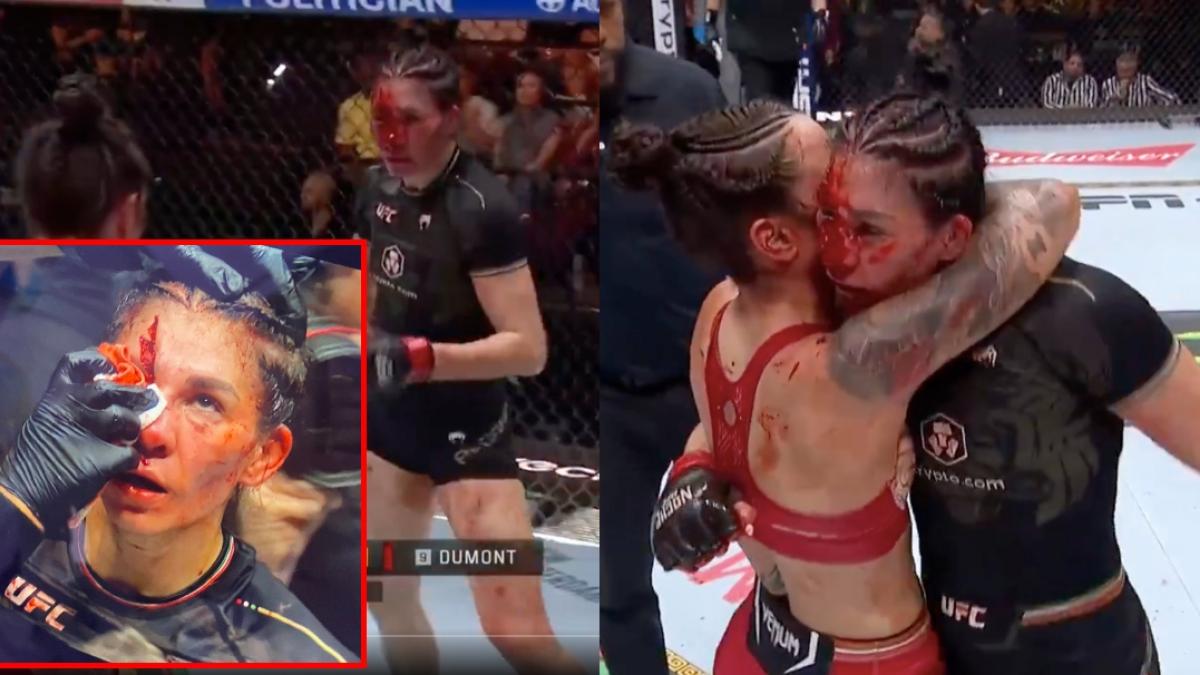 UFC 306: Irene Aldana y la TERRORÍFICA cortada en toda la cara que pone en riesgo su salud (VIDEO)