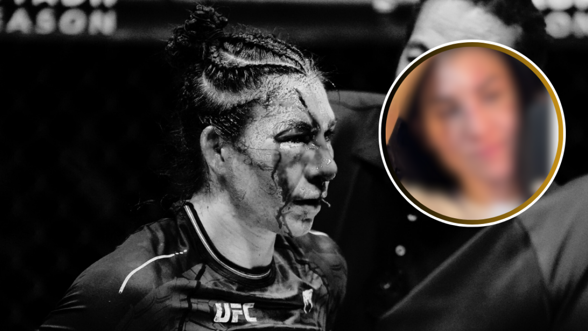 UFC: Irene Aldana muestra su cara tras retirar los puntos de sutura, su cambio es impresionante (VIDEO)