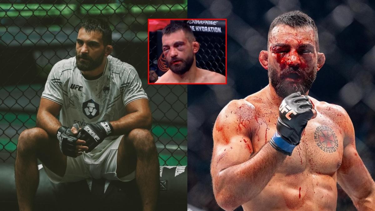 UFC París: Benoit Saint Denis y su antes y después de una sangrienta guerra ante Renato Moicano (VIDEO)