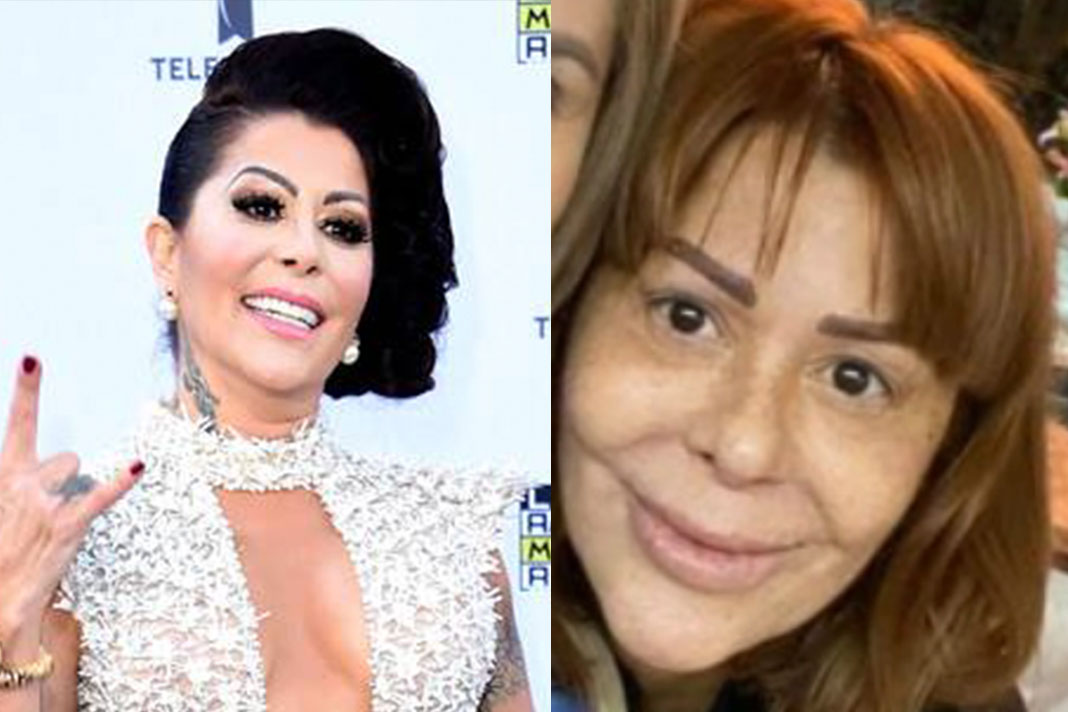 Alejandra Guzmán, así ha sido la transformación de su rostro (FOTOS)